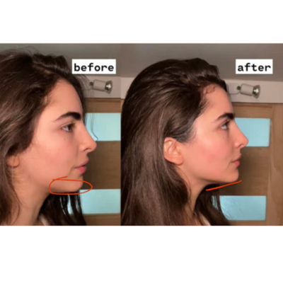 AIRI Debloat Support Capsules (Monthly)